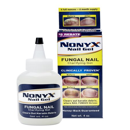 Nonyx Fungal Nail Clarifying Gel - Walmart.com