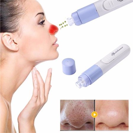 WALFRONT Electric Facial Blackhead Vacuum Suction Remover, Pore Cleanser Kit Black Heads Extraction Beauty